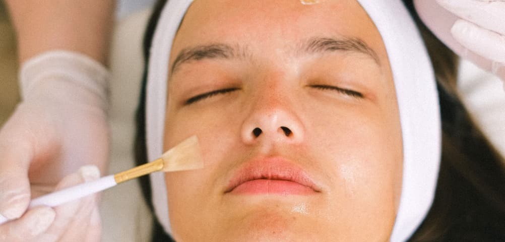 background relacionado ao procedimento Microagulhamento