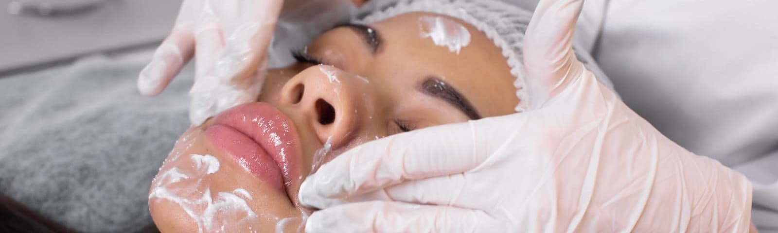 background relacionado ao procedimento Peelings