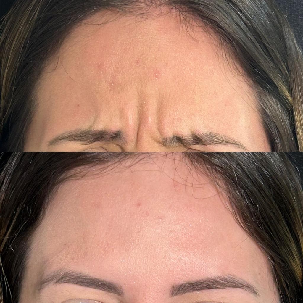 Imagem sem descriçāo