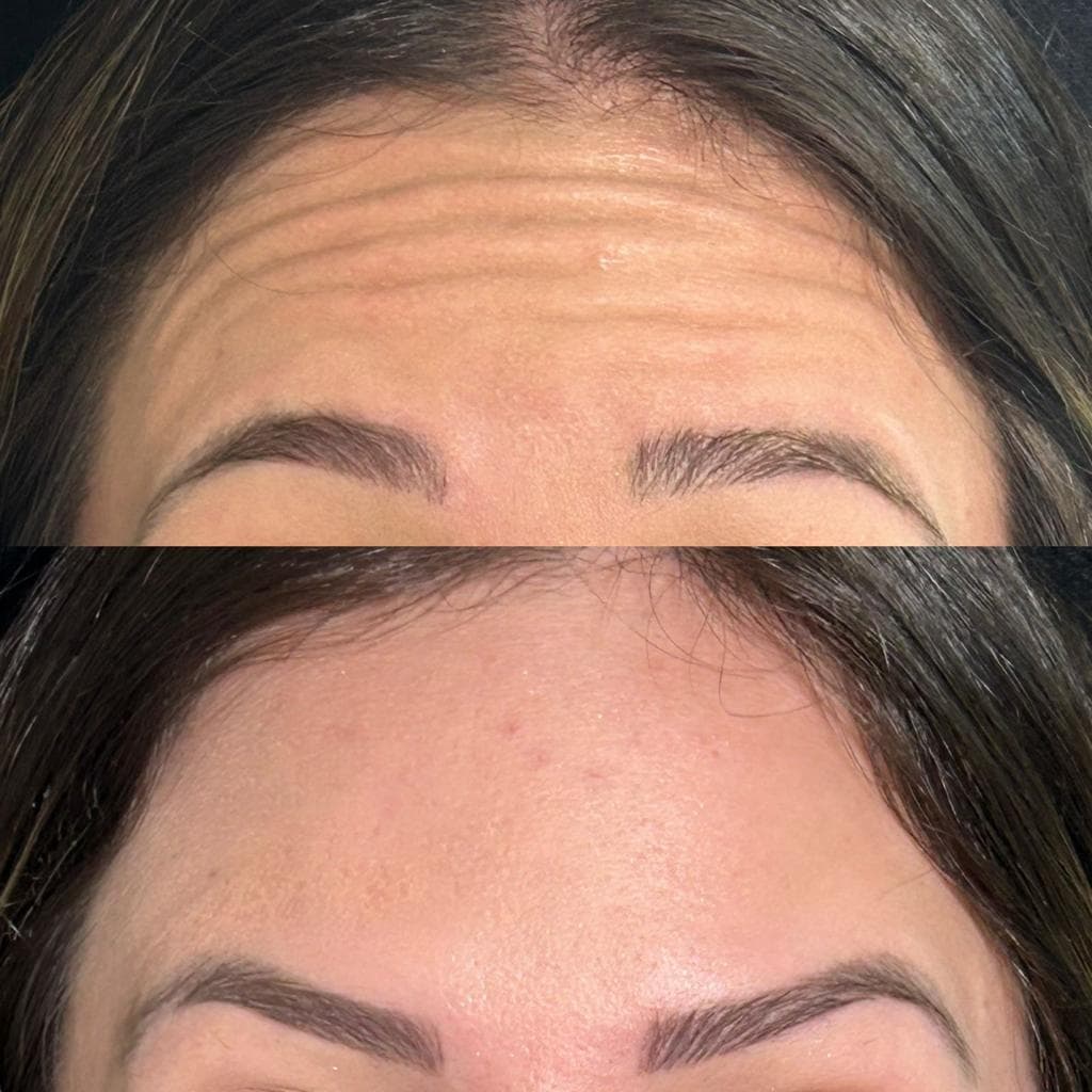 Imagem sem descriçāo