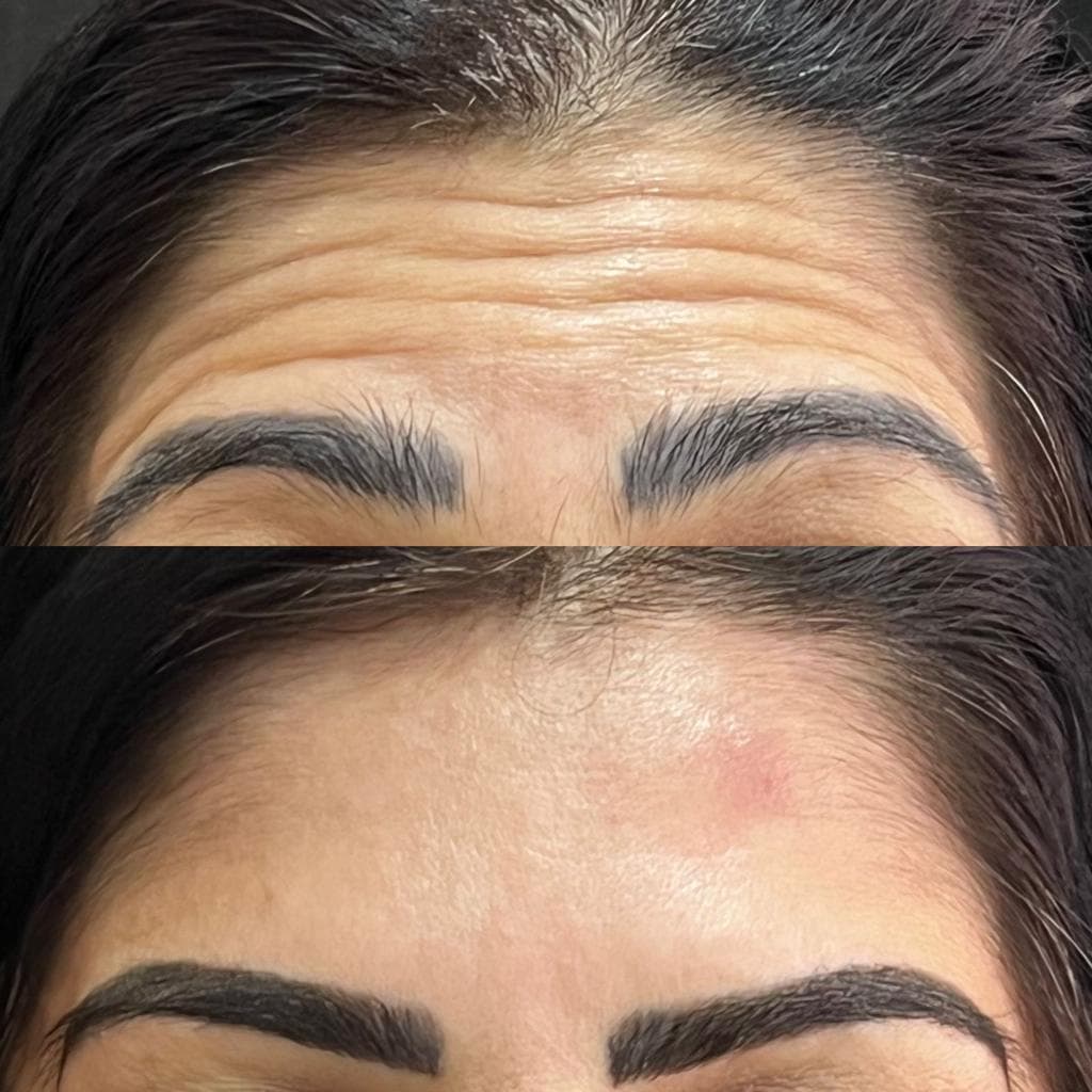 Imagem sem descriçāo