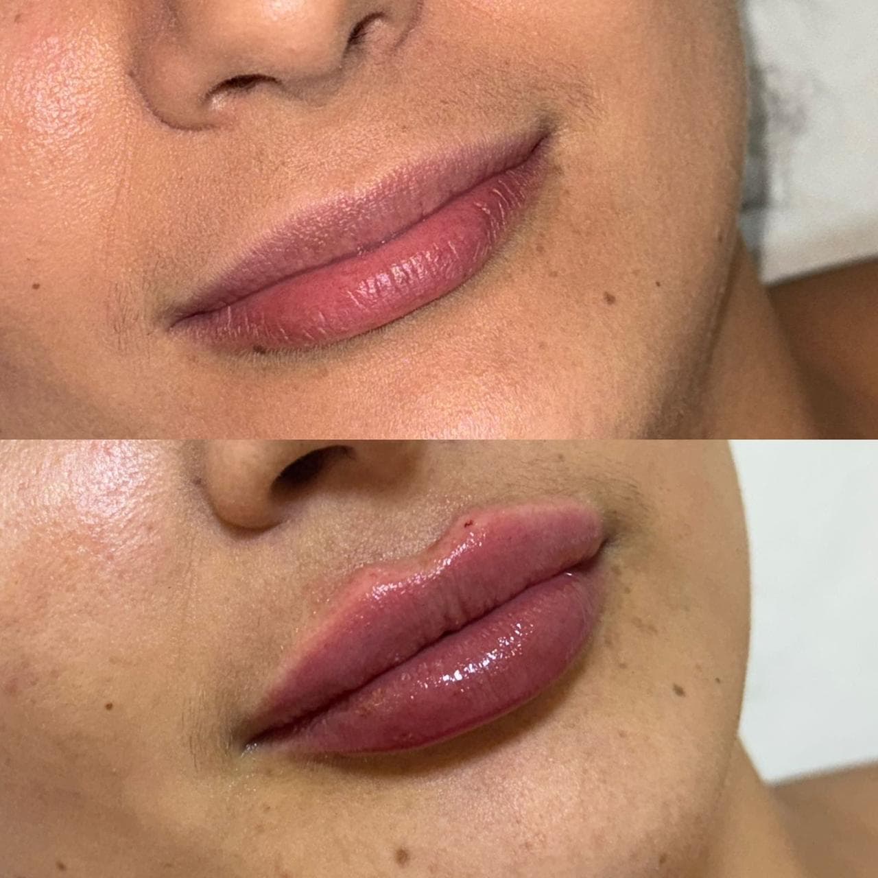 Imagem sem descriçāo